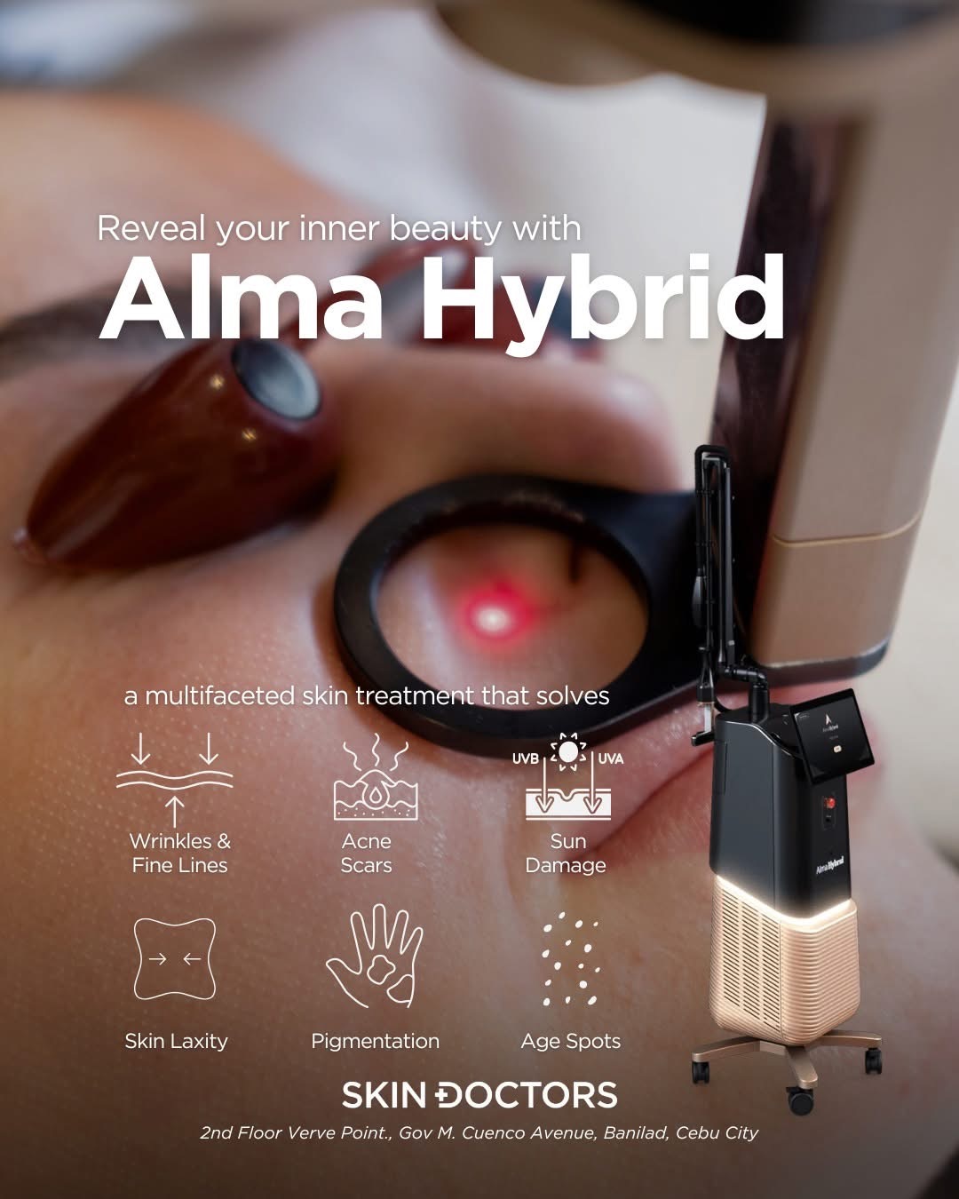 Alma Hybrid treatment photograph